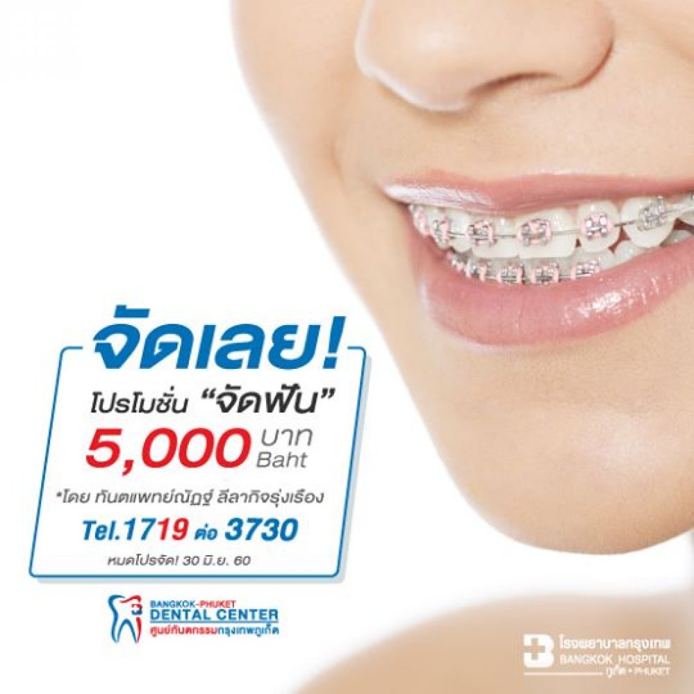 Braces Phuket Dental Care