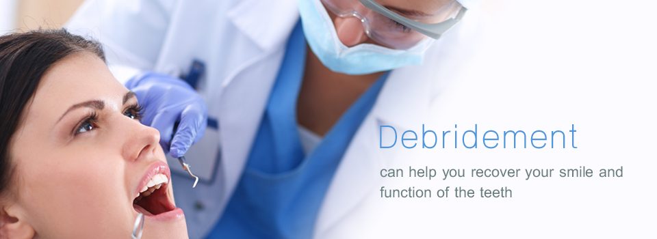 Dental Debridement