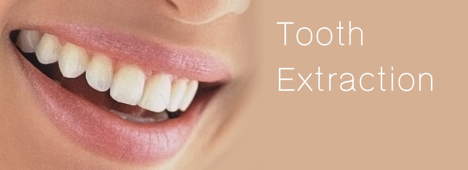 Tooth Extraction