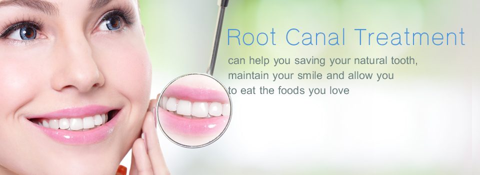 Root Canal Treatment