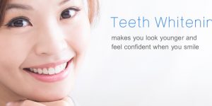 Teeth Whitening